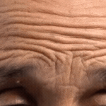 forehead